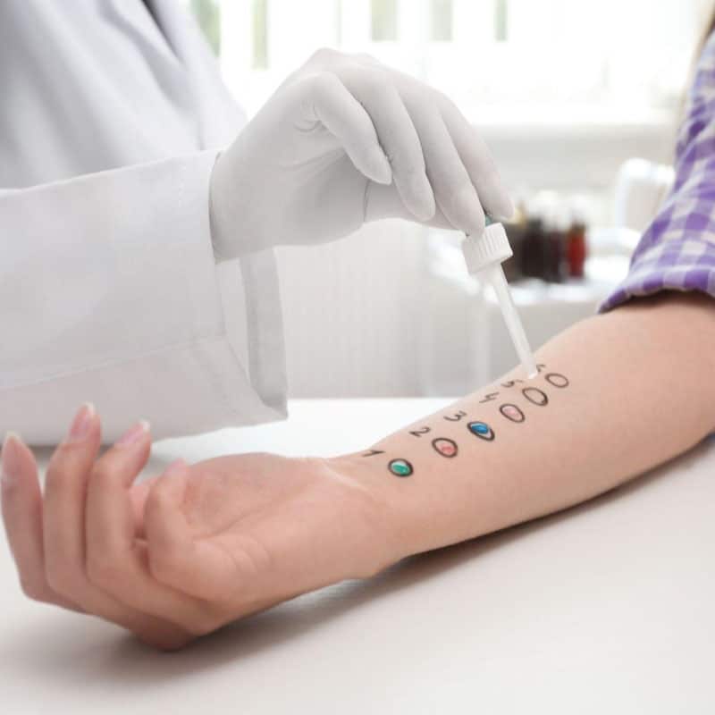 What happens after allergy testing What happens after allergy testing